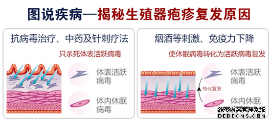 生殖器疱疹有什么诊断办法